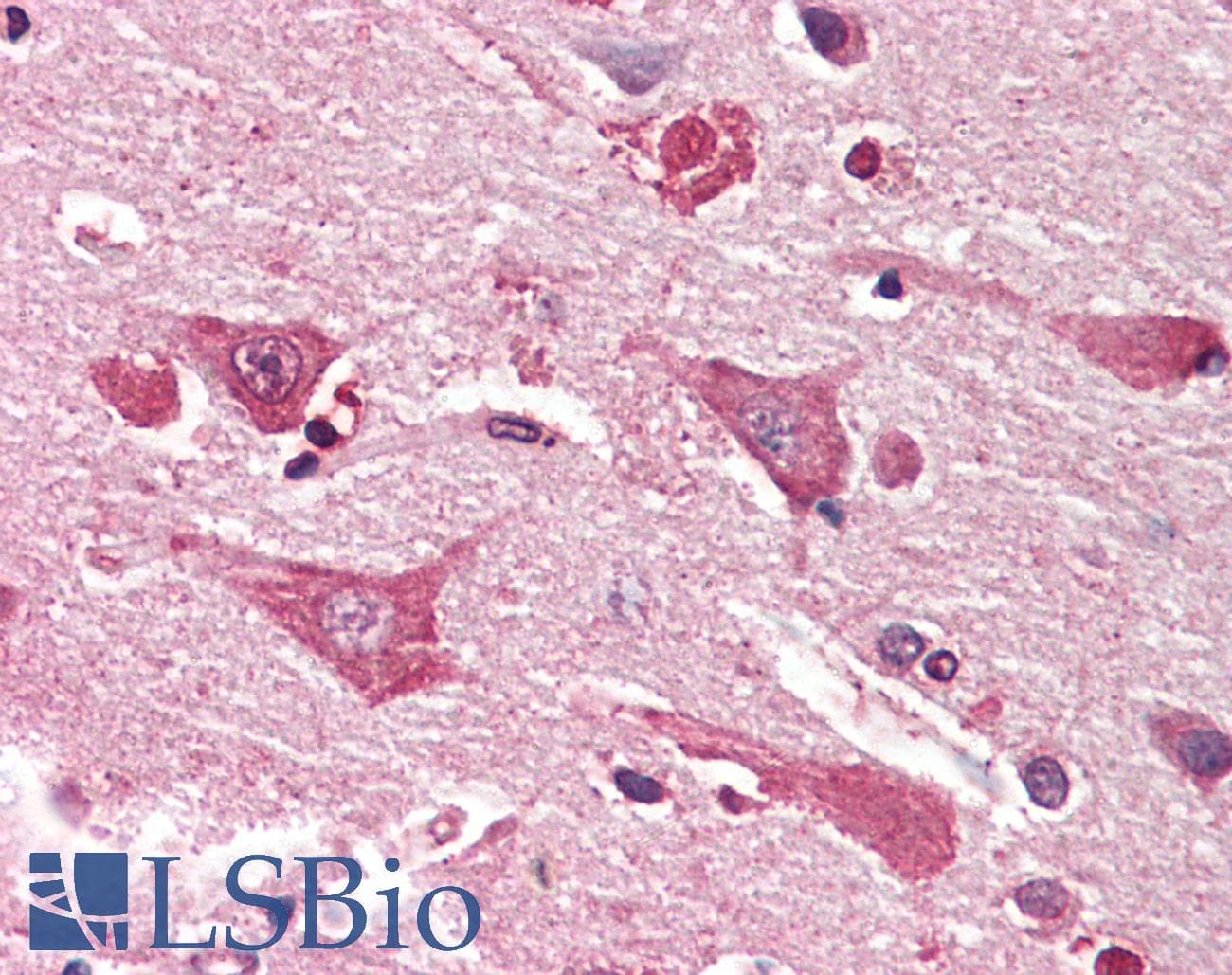 IHC-plus™ MYO1B / Myosin IB Antibody (aa327-339)
