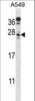 Polyclonal Rabbit anti-Human C4orf49 / OSAP Antibody (aa176-204, IHC, WB)