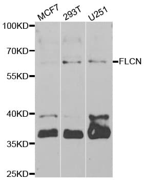 Polyclonal Rabbit anti-Human FLCN / Folliculin Antibody (IHC, IF, WB)