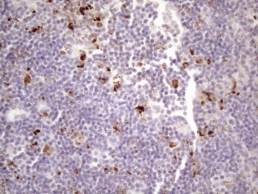 NR2C2 / TAK1 Antibody (aa1-241, clone OTI1B1)