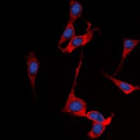 SSTR1 Antibody (N-Terminus)