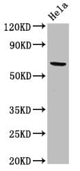 Polyclonal Rabbit anti-Human ACADVL Antibody (IHC, IF, WB)