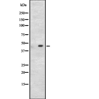 CD209 / DC-SIGN Antibody
