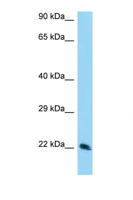 TSN / Translin Antibody (aa113-162)