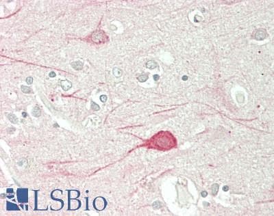 IHC-plus™ Polyclonal Rabbit anti-Human LTK Antibody (aa192-241, IHC, WB)