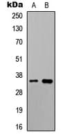 Polyclonal Rabbit anti-Human UBR1 Antibody (Internal, IHC, WB)