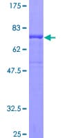 Human INPP5K / SKIP Protein (Recombinant GST)