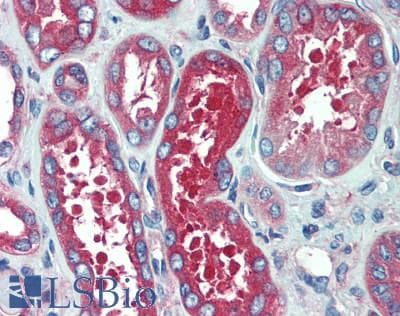 IHC-plus™ TFG Antibody (aa125-175)