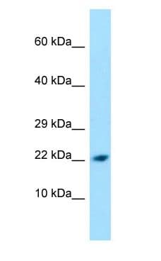 Polyclonal Rabbit anti-Human PPIL1 Antibody (aa28-77, WB)
