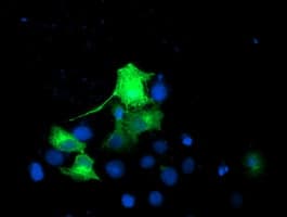 EPN2 Antibody (clone OTI1F1)