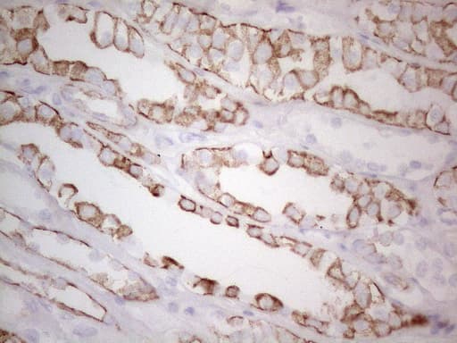 KRT19 / CK19 / Cytokeratin 19 Antibody (aa240-390, clone UMAB187, Carrier-free)