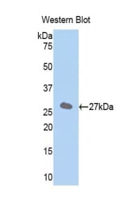 SLC27A5 / BACS Antibody (aa471-689, Biotin)