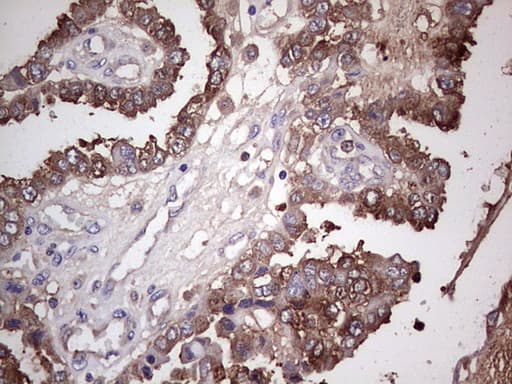 Monoclonal Mouse anti-Human PKM2 Antibody (clone 1F12, IHC, WB)