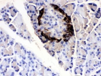 Polyclonal Rabbit anti-Human VIP Antibody (IHC)