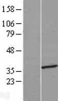 HMGCLL1 Protein (Over-Expression Lysate Myc-DDK (Flag))