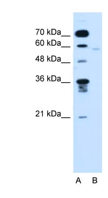 FMO3 Antibody (aa81-130)