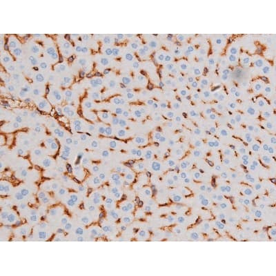 IRS1 Antibody (phospho-Ser639)