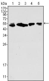 IHC-plus™ KRT8 / CK8 / Cytokeratin 8 Antibody (clone 8A5D12)