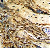 MGMT Antibody (aa156-182)