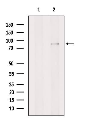 Polyclonal Rabbit anti-Human GGCX Antibody (IF, WB)