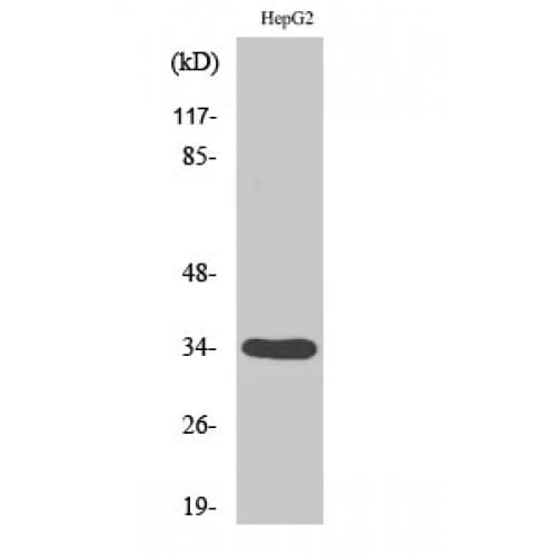 DHRS4 / PSCD Antibody (160-240 aa, C-terminal)