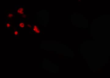Polyclonal Rabbit anti-Human GAX / MEOX2 Antibody (IF, WB)