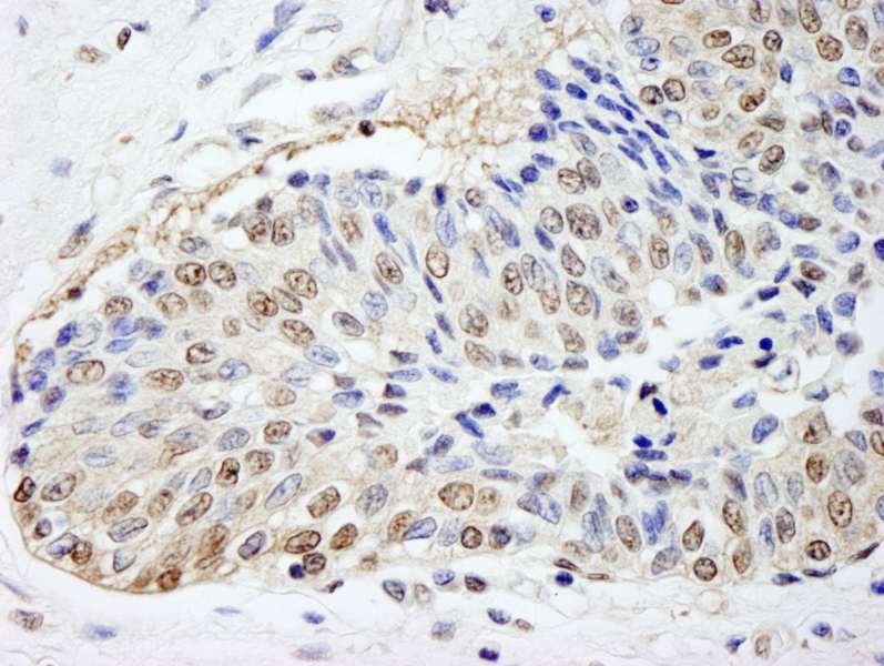 IHC-plus™ Polyclonal Rabbit anti-Human FKBP4 / FKBP52 Antibody (aa1-50, IHC, IF)