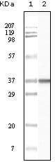 Monoclonal Mouse anti-Human BLK Antibody (clone 9D10B7H6, 9D10A8F8, IHC, WB)