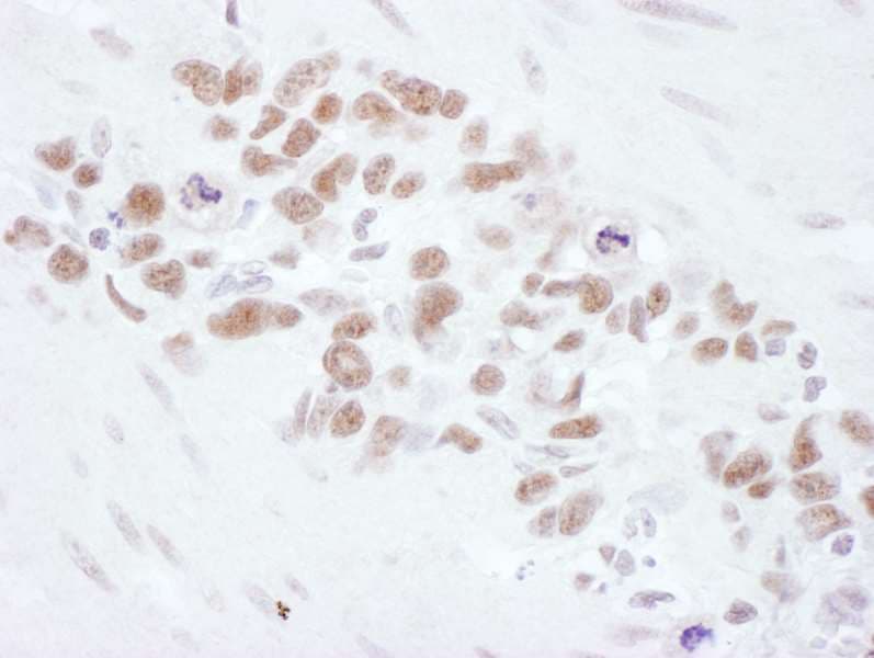 Polyclonal Rabbit anti-Human MRE11A / MRE11 Antibody (aa658-708, IHC, WB)