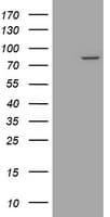 Monoclonal Mouse anti-Human SOLO / SESTD1 Antibody (clone OTI3A11, WB)