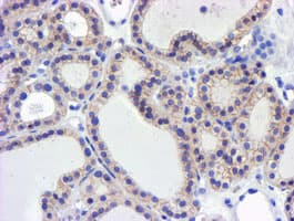 GSTO2 Antibody (clone OTI2A12)