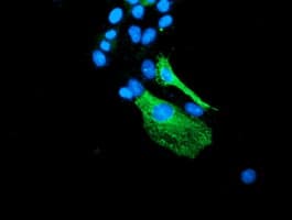 VMD2L3 / BEST3 Antibody (clone OTI1H5)