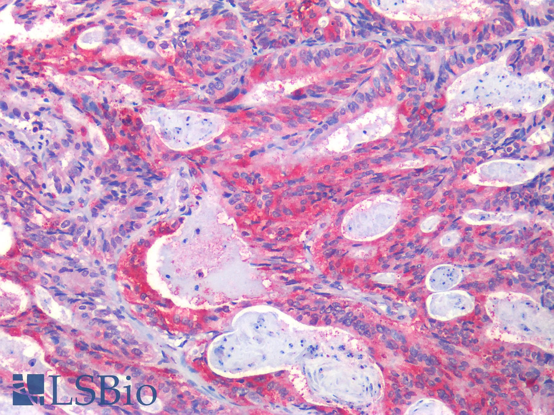 PathPlus™ EPHB2 / EPH Receptor B2 Antibody (Internal)