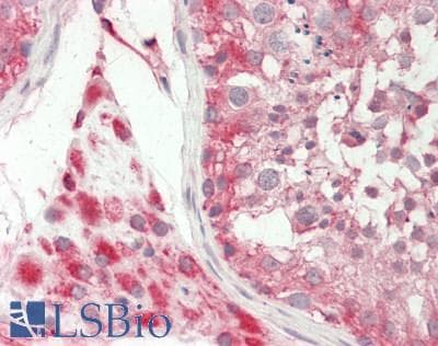 IHC-plus™ PON1 / ESA Antibody