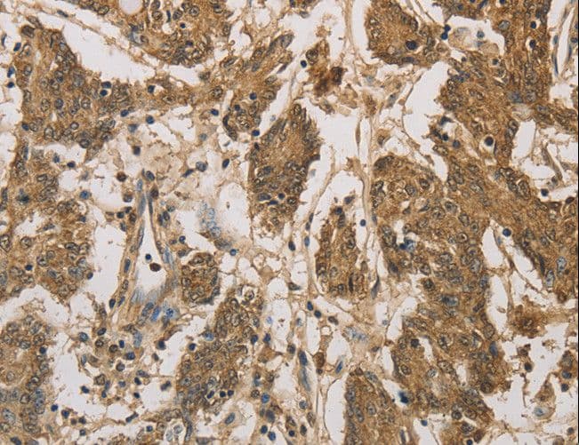 Polyclonal Rabbit anti-Human DACH / DACH1 Antibody (IHC)