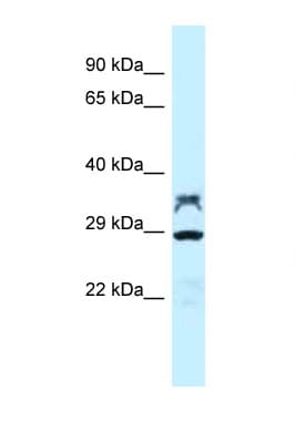 Polyclonal Rabbit anti-Rat PP2Ac / PPP2CA Antibody (aa188-237, WB)