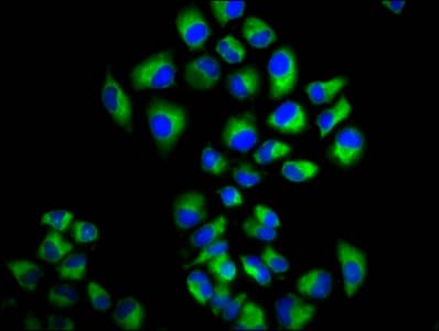 Polyclonal Rabbit anti-Human LRIG2 Antibody (IF, WB)