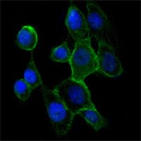 PathPlus™ Monoclonal Mouse anti-Human CDH2 / N Cadherin Antibody (clone 5D5, IHC, IF, WB)