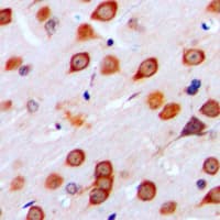 Polyclonal Rabbit anti-Human GRM4 / MGLUR4 Antibody (C-Terminus, IHC, IF, WB)