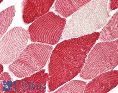 IHC-plus™ Polyclonal Rabbit anti-Human MLC3F / MYL1 Antibody (IHC, WB)