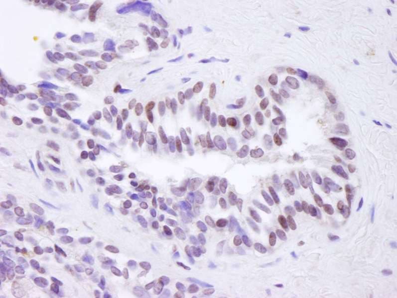 Polyclonal Rabbit anti-Human BRD8 Antibody (aa225-275 of isoform 2, IHC)