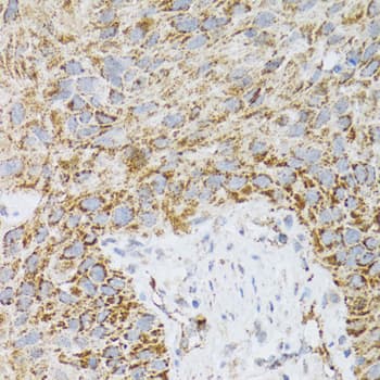 Polyclonal Rabbit anti-Human PDYN / ProDynorphin Antibody (IHC, WB)