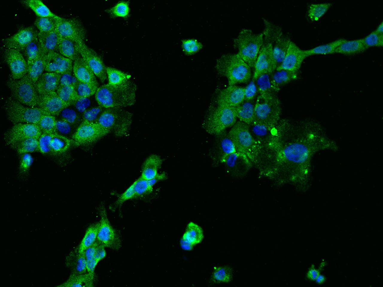 S100B / S100 Beta Antibody