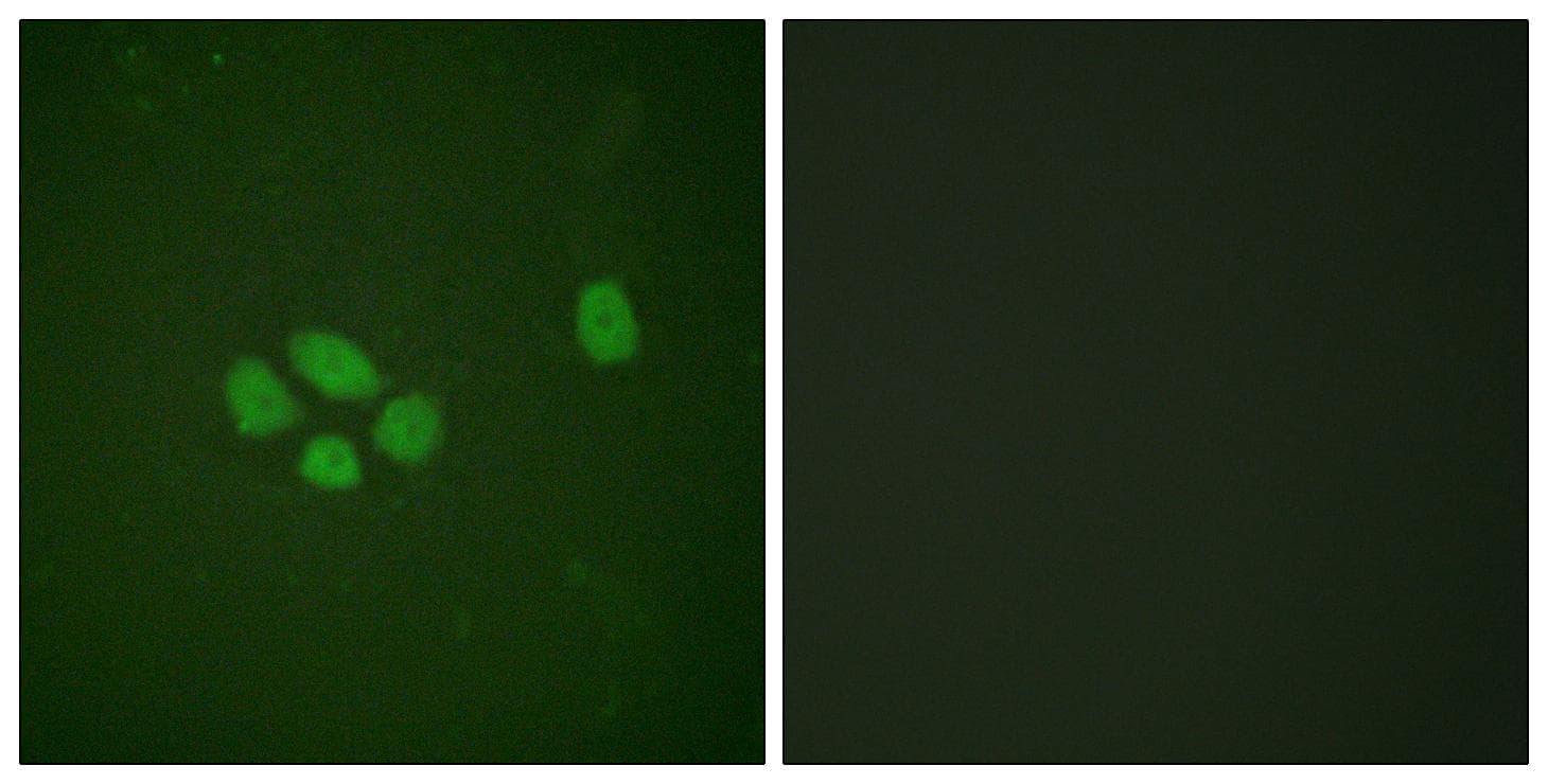 SOX9 Antibody (phospho-Ser181)