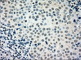 MRI1 Antibody (clone OTI6A10)