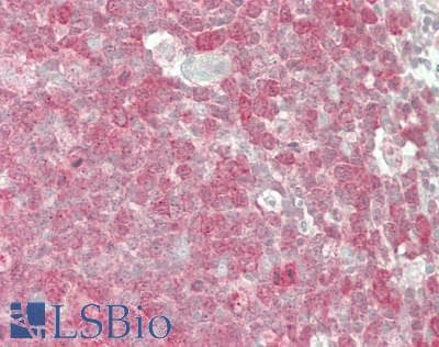 IHC-plus™ Polyclonal Rabbit anti-Human DHFR Antibody (IHC, WB)