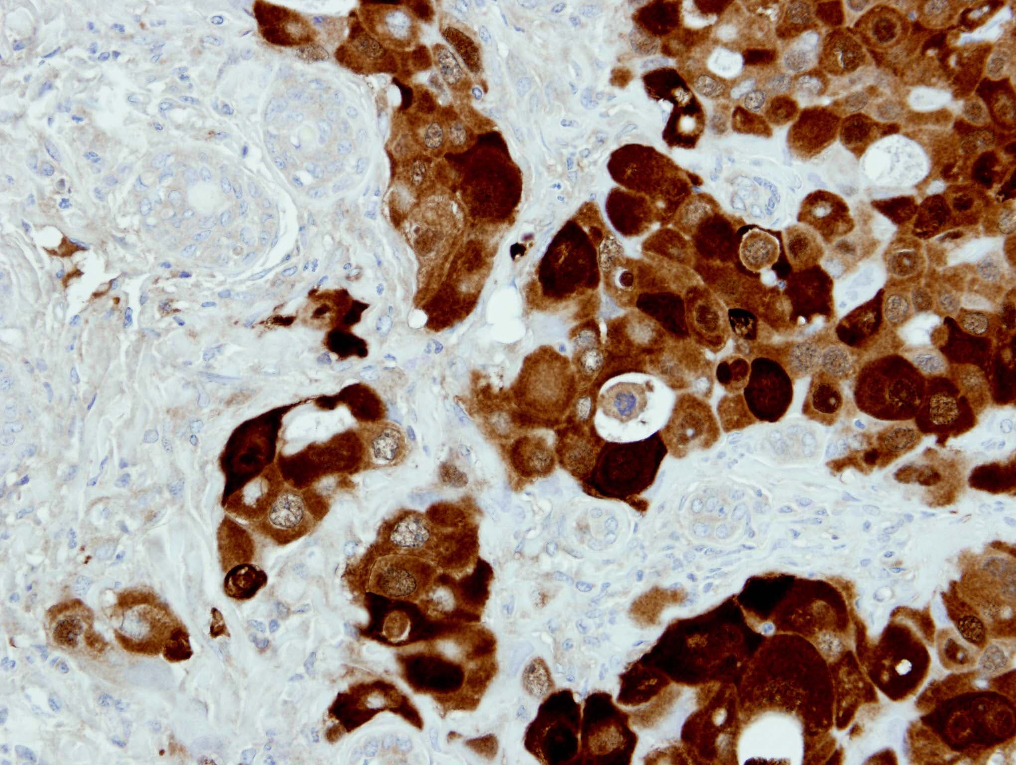 TP53I3 / PIG3 Antibody (aa1-332)