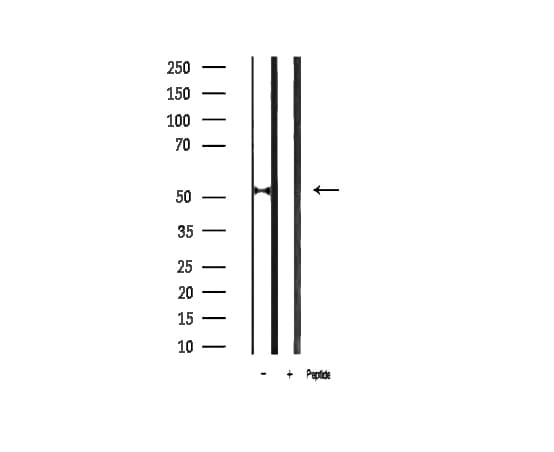 TP53 / p53 Antibody (phospho-Ser20)