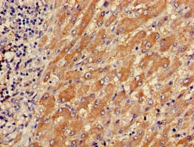 TPM3 Antibody