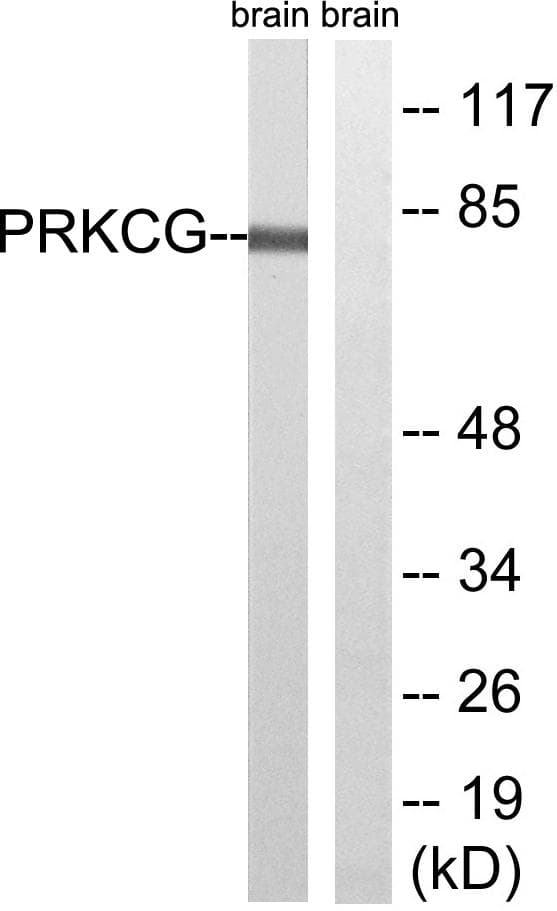 PRKCG / PKC-Gamma Antibody (p655)